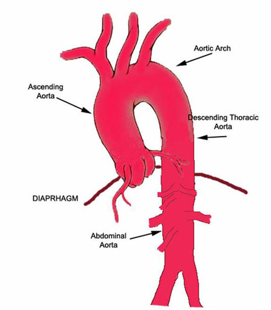 Aortic arch Image