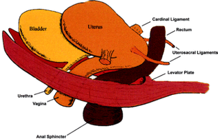 Cardinal Ligament Picture