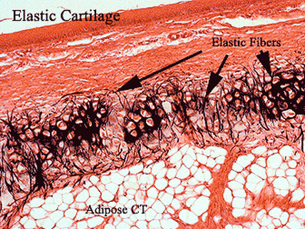 Elastic cartilage Picture