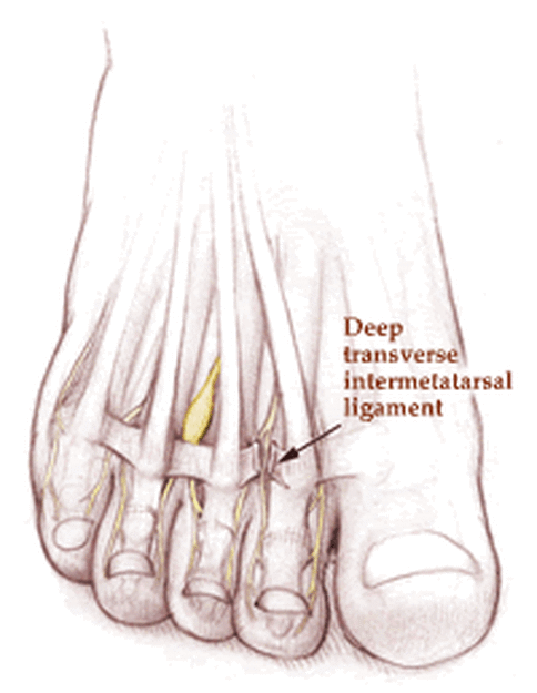 Deep transverse metatarsal ligament Picture