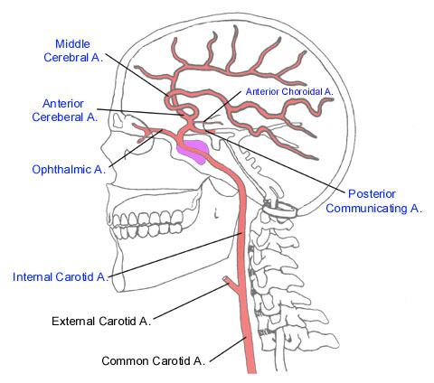 Anterior choroidal artery Image