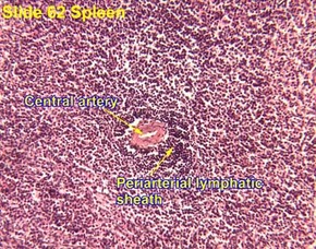 Periarteriolar lymphoid sheaths Picture