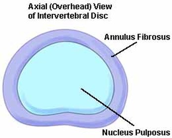 Annulus fibrosus disci intervertebralis Picture