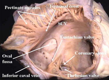Pectinate muscle Image