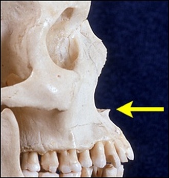 Anterior nasal spine Photo