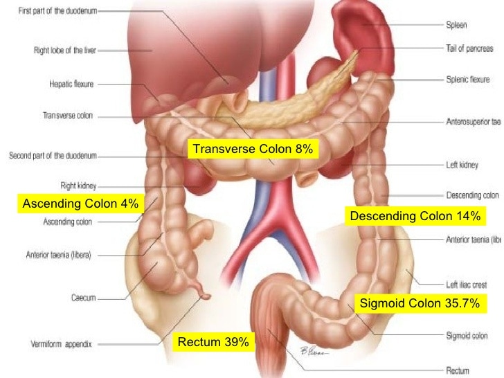 Ascending Colon – Definition, Location, Function, Problems, Cancer and