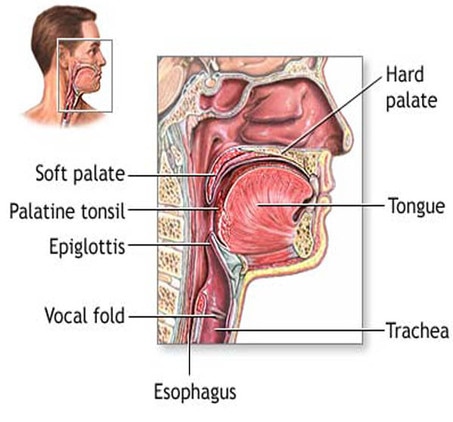 Epiglottitis Picture